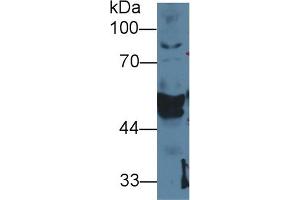 Detection of CK14 in Cavia Salivary gland lysate using Polyclonal Antibody to Cytokeratin 14 (CK14) (KRT14 antibody  (AA 1-484))