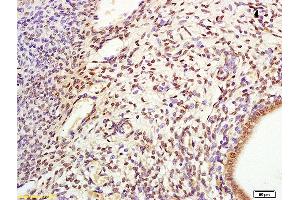 Formalin-fixed and paraffin embedded rat uterus labeled with Anti-CDC6 Polyclonal Antibody, Unconjugated (ABIN685852) at 1:200 followed by conjugation to the secondary antibody and DAB staining. (CDC6 antibody)