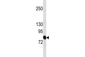 Western Blotting (WB) image for anti-Amyloid beta (A4) Precursor Protein-Binding, Family B, Member 2 (APBB2) antibody (ABIN3004490) (APBB2 antibody)