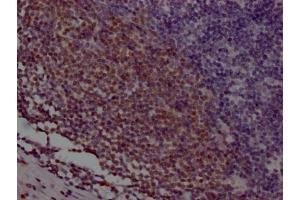 IHC image of ABIN7127370 diluted at 1:100 and staining in paraffin-embedded human appendix tissue performed on a Leica BondTM system. (Recombinant POU2AF1 antibody)