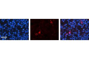 Rabbit Anti-KEAP1 Antibody   Formalin Fixed Paraffin Embedded Tissue: Human Lymph Node Tissue Observed Staining: Cytoplasm, Nucleus Primary Antibody Concentration: 1:100 Other Working Concentrations: N/A Secondary Antibody: Donkey anti-Rabbit-Cy3 Secondary Antibody Concentration: 1:200 Magnification: 20X Exposure Time: 0.