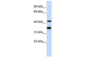 POLD2 antibody used at 1 ug/ml to detect target protein. (POLD2 antibody)