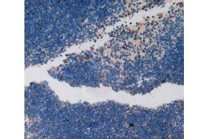 Used in DAB staining on fromalin fixed paraffin- embedded spleen tissue (Ki-67 antibody  (AA 2386-2674))