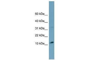 TRIM36 antibody used at 1 ug/ml to detect target protein.
