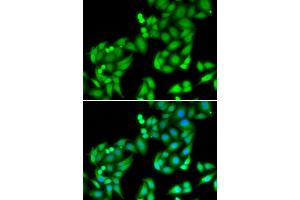 Immunofluorescence analysis of U2OS cells using COPS3 antibody.