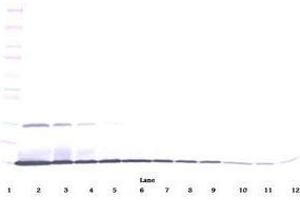 Image no. 1 for anti-Interleukin 22 (IL22) antibody (ABIN465488) (IL-22 antibody)