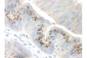 Image no. 2 for anti-Growth Regulated Oncogene gamma (GRO gamma) antibody (ABIN465909) (GRO gamma antibody)