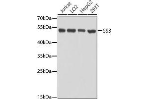 Western blot analysis of extracts of various cell lines, using SSB antibody (ABIN3015264, ABIN3015265, ABIN3015266 and ABIN6213909) at 1:1000 dilution. (SSB antibody  (AA 166-408))