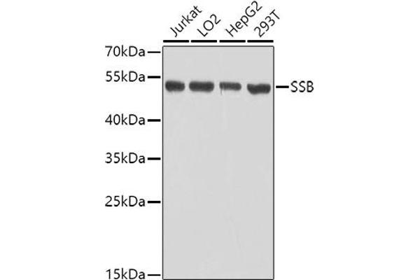 SSB antibody  (AA 166-408)
