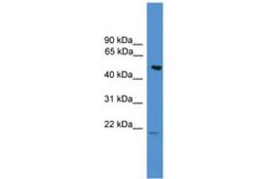 Image no. 1 for anti-Amyotrophic Lateral Sclerosis 2 (Juvenile) Chromosome Region, Candidate 12 (ALS2CR12) (AA 110-159) antibody (ABIN6745420) (ALS2CR12 antibody  (AA 110-159))