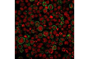 Immunofluorescence staining of MOLT-4 cells using CD20 Monoclonal Antibody (SPM494) followed by goat anti-Mouse IgG conjugated to CF488 (green). (CD20 antibody)