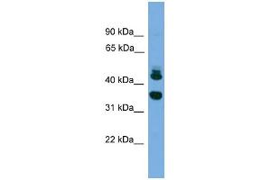 WB Suggested Anti-FLJ30934 Antibody Titration: 0. (FLJ30934 (Middle Region) antibody)