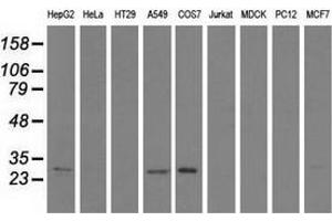 Western blot analysis of extracts (35 µg) from 9 different cell lines by using anti-SPR monoclonal antibody.