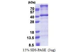 SDS-PAGE (SDS) image for Deoxynucleotidyltransferase, Terminal, Interacting Protein 1 (DNTTIP1) (AA 1-329) protein (His tag) (ABIN5853253)