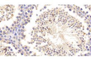 Detection of MMP1 in Mouse Testis Tissue using Polyclonal Antibody to Matrix Metalloproteinase 1 (MMP1)