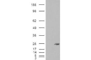 HEK293 overexpressing SAR1B (ABIN5457296) and probed with ABIN334486 (mock transfection in first lane). (SAR1B antibody  (Internal Region))