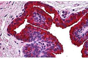 Human Prostate: Formalin-Fixed, Paraffin-Embedded (FFPE) (BCAS1 antibody  (AA 1-81))
