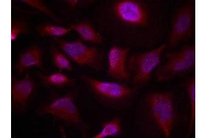 Immunofluorescence staining of methanol-fixed Hela cells using ATF2(Phospho-Thr73 or 55) Antibody. (ATF2 antibody  (pThr73))