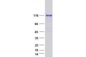 Western Blotting (WB) image for Thioredoxin Domain Containing 11 (TXNDC11) protein (Myc-DYKDDDDK Tag) (ABIN2734664)