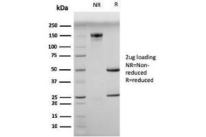 SDS-PAGE Analysis Purified Myogenin Mouse Monoclonal Antibody (MGN185). (Myogenin antibody)
