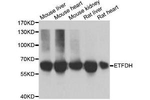 Western blot analysis of extracts of various cell lines, using ETFDH antibody. (ETFDH antibody  (AA 318-617))