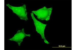 Immunofluorescence of monoclonal antibody to LMO3 on HeLa cell. (LMO3 antibody  (AA 91-146))