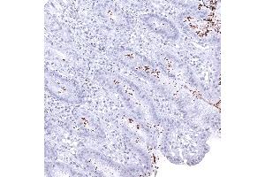 Abundant helicobacter pylori in a case of gastritis (Helicobacter Pylori antibody  (AA 323-445))