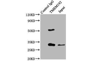 Immunoprecipitating TMEM192 in Jurkat whole cell lysate Lane 1: Rabbit control IgG (1 μg) instead of ABIN7173123 in Jurkat whole cell lysate. (TMEM192 antibody  (AA 193-271))