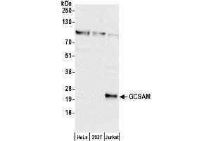 anti-Germinal Center Expressed Transcript 2 (GCET2) (AA 128-178) antibody