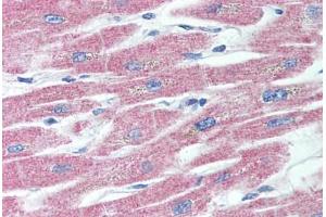 Human Heart (formalin-fixed, paraffin-embedded) stained with TNFRSF11A antibody ABIN296494 at 10 ug/ml followed by biotinylated anti-mouse IgG secondary antibody ABIN481714, alkaline phosphatase-streptavidin and chromogen. (TNFRSF11A antibody  (AA 326-616))