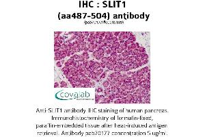 Image no. 1 for anti-Slit Homolog 1 (SLIT1) (AA 487-504) antibody (ABIN1739431) (SLIT1 antibody  (AA 487-504))
