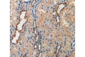 Used in DAB staining on fromalin fixed paraffin- embedded kidney tissue (IGFBP6 antibody  (AA 31-240))