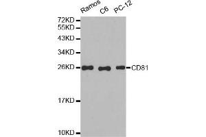 Western blot analysis of extracts of various cell lines, using CD81 antibody. (CD81 antibody)