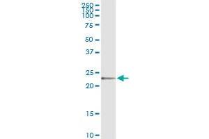 Immunoprecipitation of FKBP11 transfected lysate using anti-FKBP11 MaxPab rabbit polyclonal antibody and Protein A Magnetic Bead , and immunoblotted with FKBP11 purified MaxPab mouse polyclonal antibody (B01P) . (FKBP11 antibody  (AA 1-201))