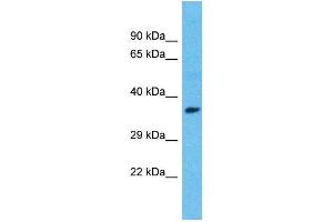 Host:  Rabbit  Target Name:  ISL1  Sample Type:  Breast Tumor lysates  Antibody Dilution:  1. (ISL1 antibody  (C-Term))