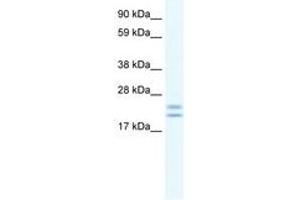 Image no. 1 for anti-Tubulin Polymerization Promoting Protein (Tppp) (C-Term) antibody (ABIN202076) (Tppp antibody  (C-Term))