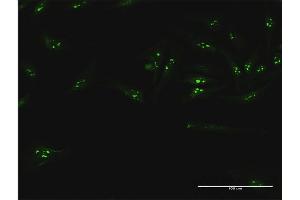 Immunofluorescence of purified MaxPab antibody to UTP18 on HeLa cell. (UTP18 antibody  (AA 1-521))