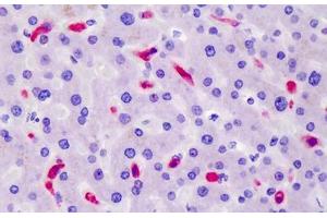 Human Liver: Formalin-Fixed, Paraffin-Embedded (FFPE) (CD163 antibody)