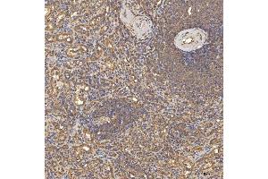 IHC analysis of TST using anti-TST antibody (ABIN7599105).