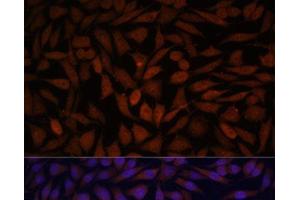 Immunofluorescence analysis of L929 cells using KLHL8 Polyclonal Antibody at dilution of 1:100. (KLHL8 antibody)