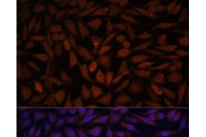Immunofluorescence analysis of L929 cells using KLHL8 Polyclonal Antibody at dilution of 1:100.