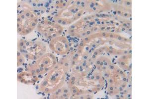 Used in DAB staining on fromalin fixed paraffin- embedded kidney tissue (TSTA3 antibody  (AA 1-321))