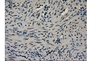 Immunohistochemical staining of paraffin-embedded Ovary tissue using anti-CTAG1Bmouse monoclonal antibody.