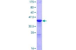 Image no. 1 for Glia Maturation Factor, gamma (GMFG) (AA 1-142) protein (GST tag) (ABIN1355297) (GMFG Protein (AA 1-142) (GST tag))