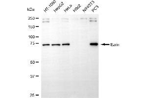 Western blotting analysis using ezrin antibody (ABIN7798552).