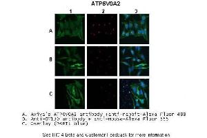 Application: IHC/Immunofluorescence Species+tissue/cell type:A. (ATP6V0A2 antibody  (N-Term))