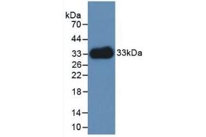 Detection of Recombinant LAMC1, Human using Polyclonal Antibody to Laminin Gamma 1 (LAMC1) (Laminin gamma 1 antibody  (AA 521-772))