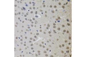 Immunohistochemistry of paraffin-embedded mouse brain using MKL1 antibody. (MKL1 antibody)