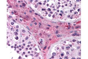 Immunohistochemistry (IHC) image for anti-Nuclear Receptor Subfamily 1, Group H, Member 4 (NR1H4) (AA 194-243) antibody (ABIN214795)