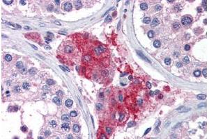 Human Testis (formalin-fixed, paraffin-embedded) stained with ACYP1 antibody ABIN351487 at 3. (ACYP1 antibody  (AA 72-85))